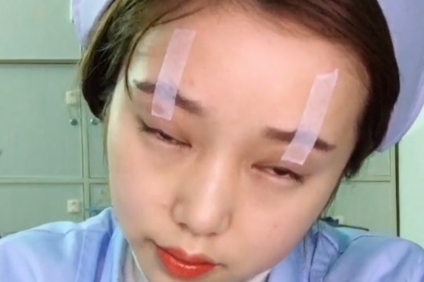 搞笑gif趣图:古有头悬梁锥刺股,今有护士妹子胶布粘眼皮!