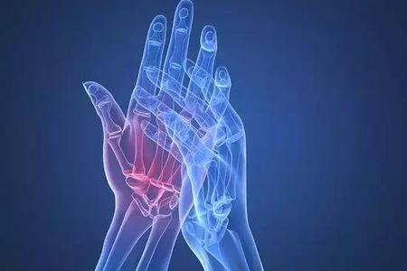 类风湿关节炎(ra)患者接受联合治疗