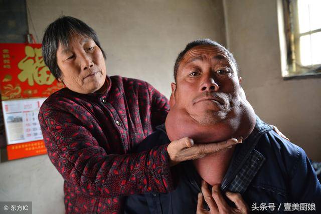“脑袋大脖子粗不是大款就是伙夫”，老农的脖子比头粗睡觉常憋醒