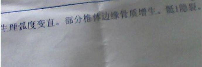 腰椎生理曲度变直严不严重该怎么治疗