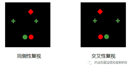 天津万里路视光培训学校同侧性复视交叉性复视