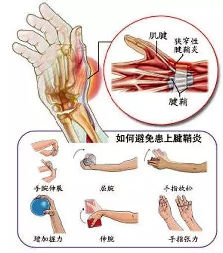 呈窜痛,冷痛,胀痛,酸痛,得温则舒.遇寒痛增,关节附近肌肉僵硬和萎缩.