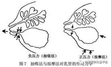 哺乳期间出现急性乳腺炎可怎么办?