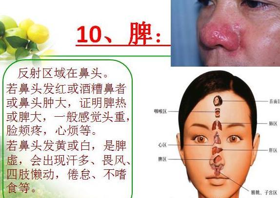 看面相诊病(六)——面部代表五脏六腑