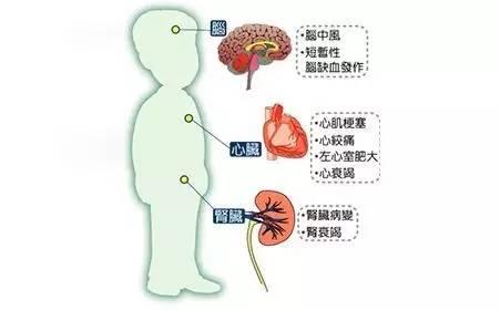 叶酸对高血压患者血压控制及心脑血管不良事件的影响