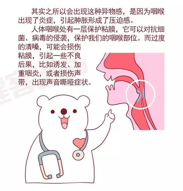 咳咳,嗓子痒停不下来?慢性咽炎你得这样保护咽喉