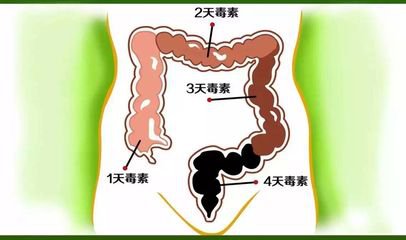 气、汗、尿、血、脂、痰、宿便，体内七毒怎么办?