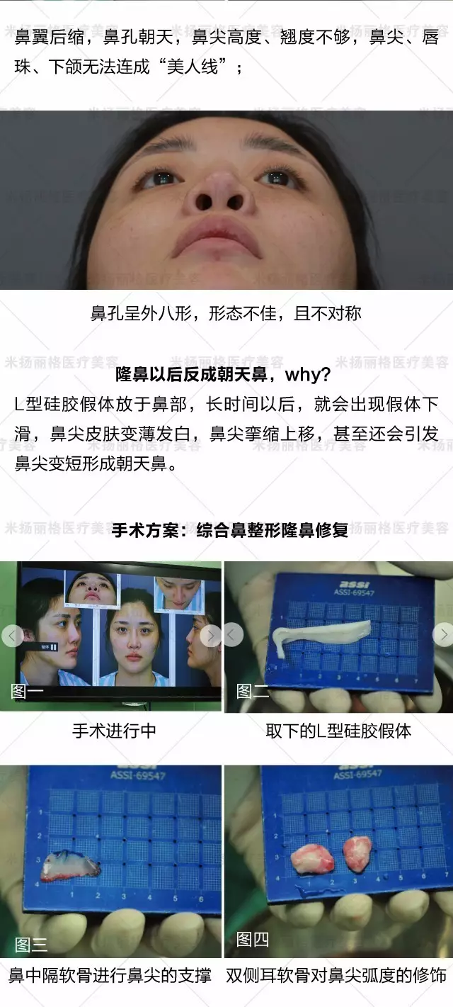 那什么拯救你,我的朝天鼻?