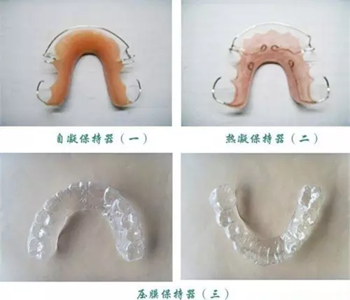 活动保持器由钢丝和塑料构成,外形与简单的活动假牙类似,主要位咏】