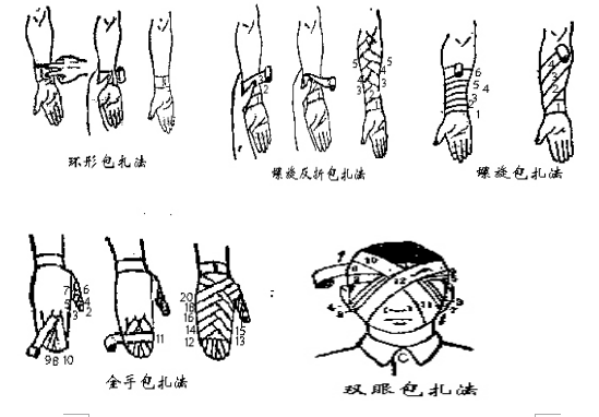 (2)绷带包扎法