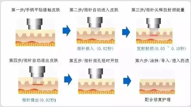 点阵射频的原理是什么_点阵式布局是什么意思