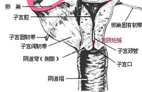 输卵管有粘连,身体会出现什么样的感觉?