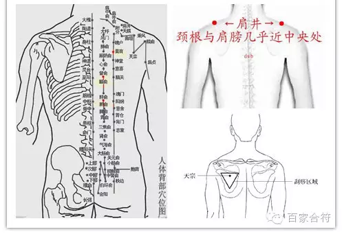 "乳腺增生"怕刮痧--看痧点儿辨轻重