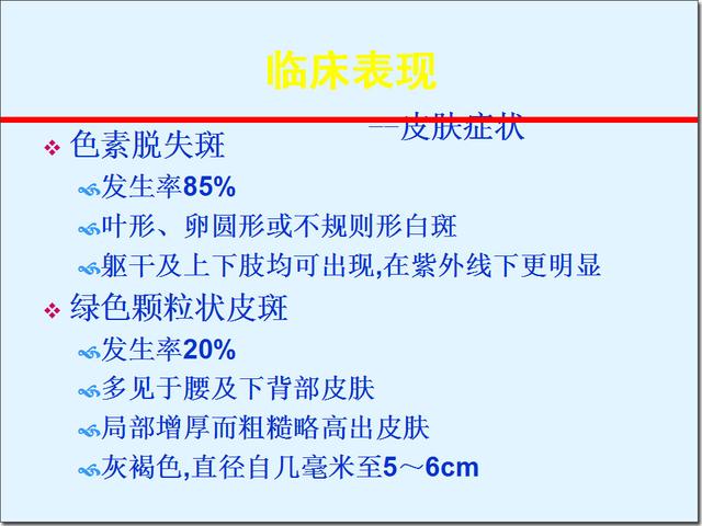 结节性硬化症