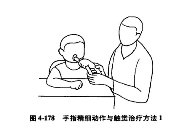 肌张力低下型脑瘫患儿的作业治疗方法(举例汇总)