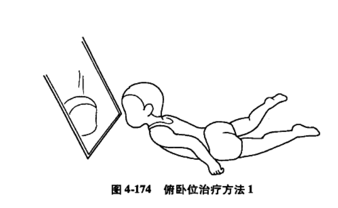 肌张力低下型脑瘫患儿的作业治疗方法(举例汇总)