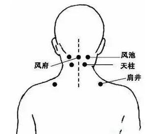 艾灸调理脑供血不足