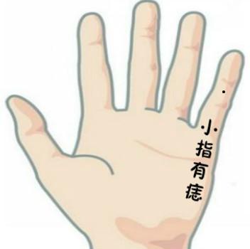 解析手指长痣的寓意, 哪根手指长痣桃花多?