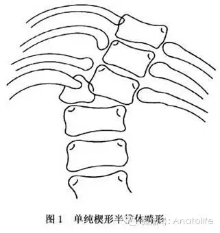 半椎体 7 脊柱的运动 特点:相邻两椎骨之间运动范围很小,但整个连结