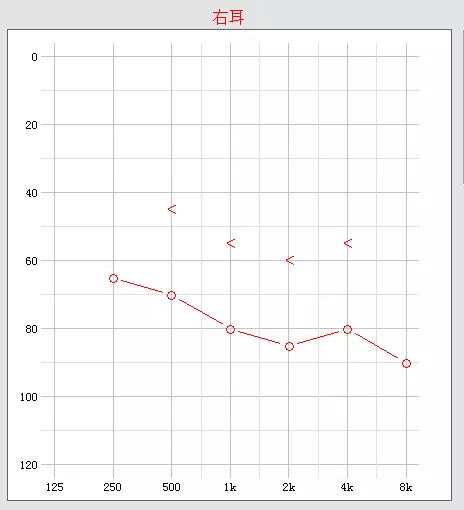 想要读懂听力图,你需要认识这只重要的香蕉