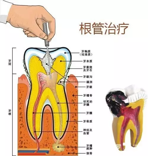 龃龋