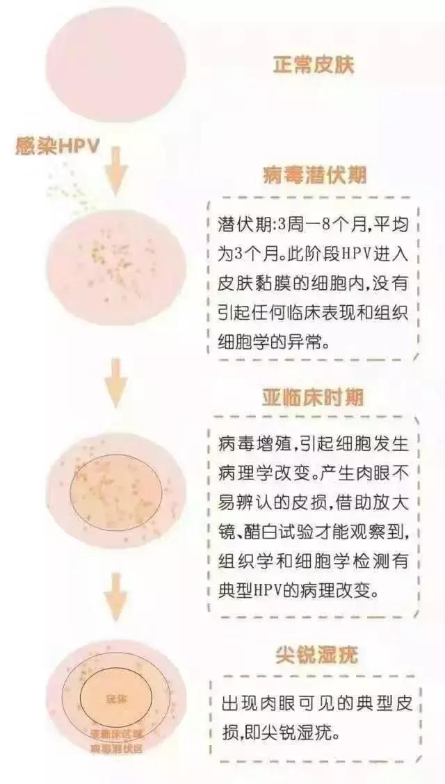 尖锐湿疹图片高清