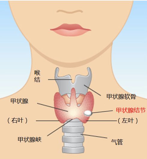 甲状腺癌的早期症状怎么发现?