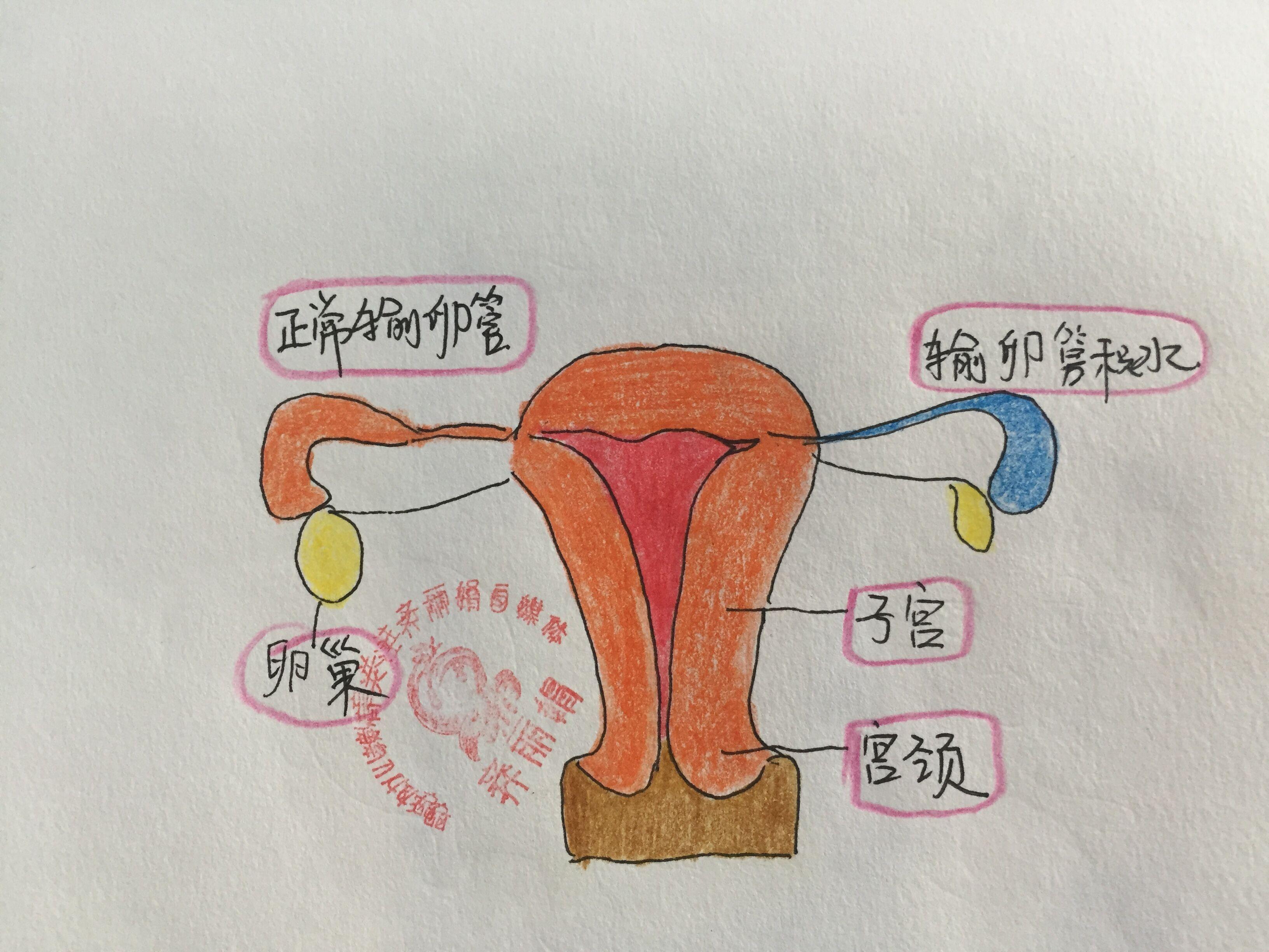 备孕妈妈27岁输卵管积水,备孕女性请重视孕前检查