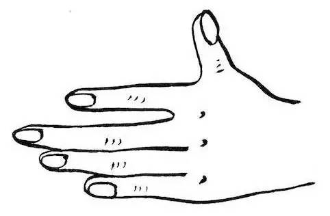 手诊自测指甲透露小秘密4种简单指甲诊断方法