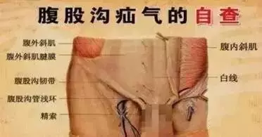 防治疝气,腹部胀痛