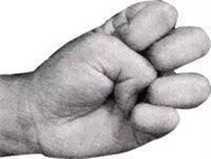 五雷指: 左手五指均收伏在掌心,但须注意指甲不可.