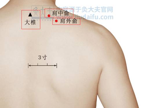 大椎穴,肩中俞,肩外俞,肩井穴,神阙,阿是穴