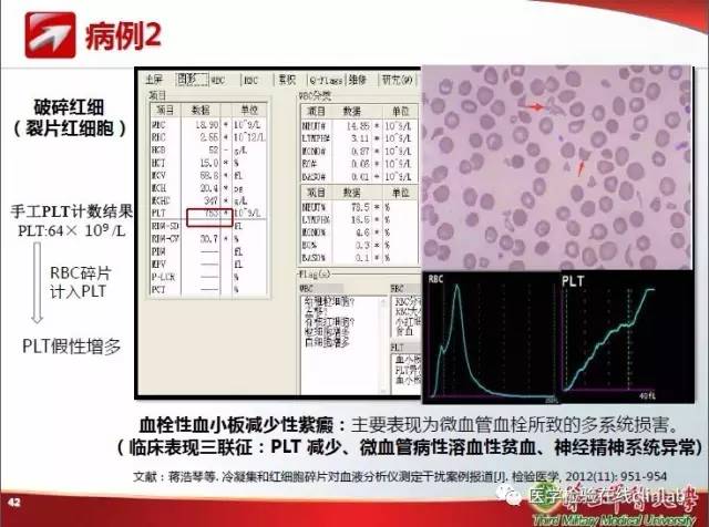 血常规检验中的质量控制