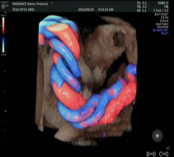"新同事"能够真实地呈现胎儿心脏结构,脐带,血流变化,使医生能够更