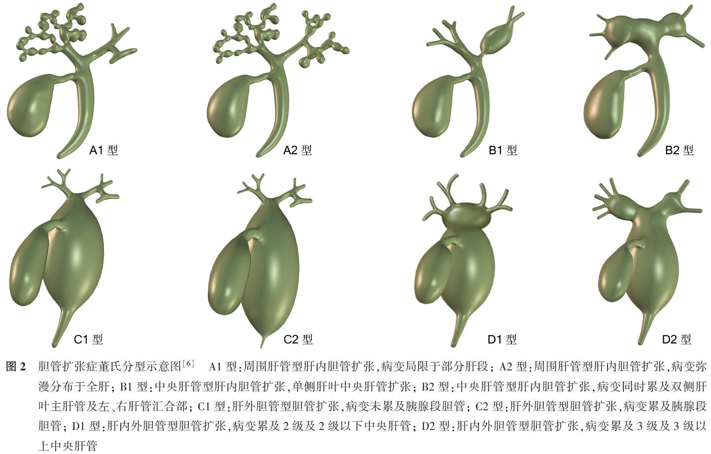 最新胆管扩张症诊治指南发布