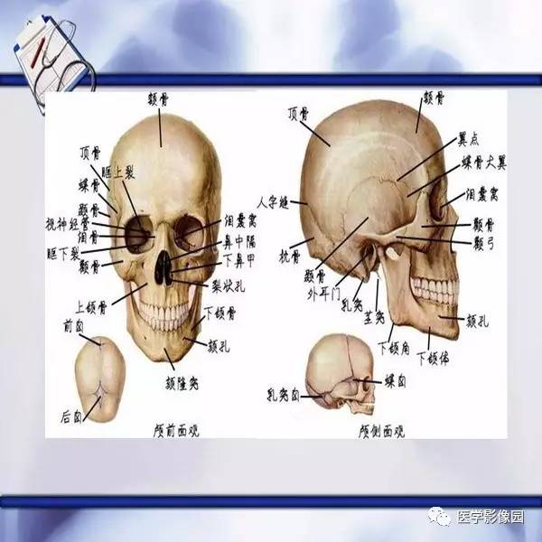 口腔颌面医学影像诊断学颌面骨骨折及系统性疾病丨
