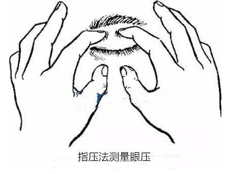 指测法 :用手指触摸眼球感觉像触到额部:眼压高感觉像触到鼻子:正常
