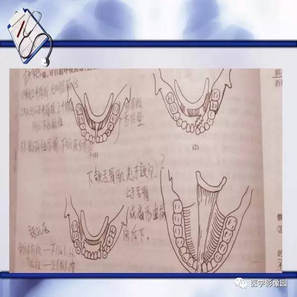 口腔颌面医学影像诊断学颌面骨骨折及系统性疾病丨