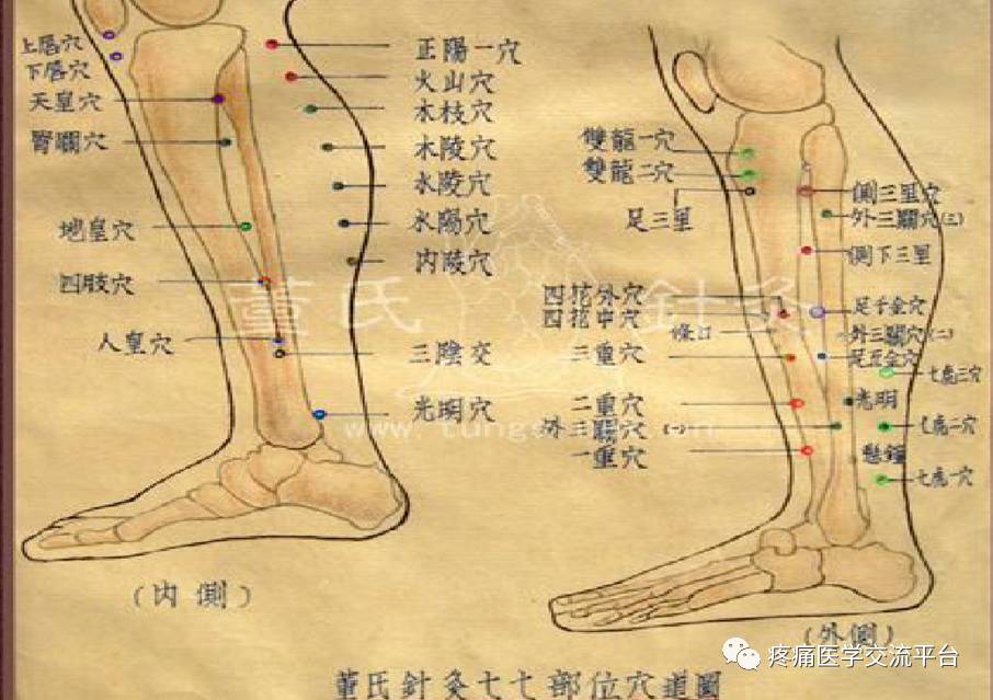 董氏奇穴常见穴位