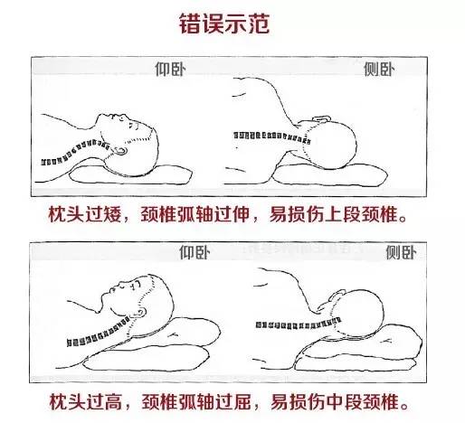 侧睡: 颈椎与身体中线在同一水平面上,不能有明显的颈部弯曲,肩部