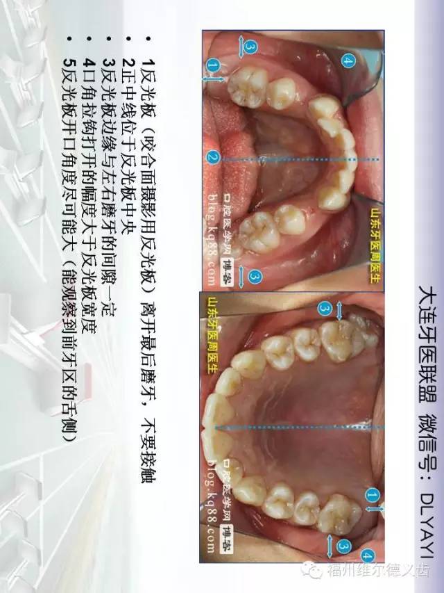 口腔数码摄影全攻略真人示范珍藏版