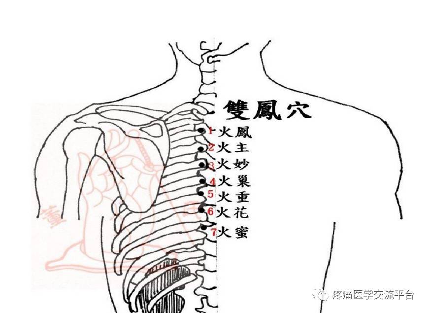 董氏奇穴常见穴位