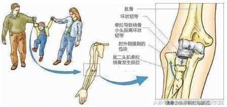 正常人体解剖学 认识自己人体六大关节之肘关节