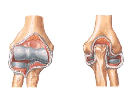 正常人体解剖学认识自己人体六大关节之肘关节
