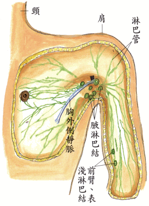 副乳:腋下淋巴结堵塞!