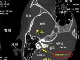 大前庭可以生二胎吗