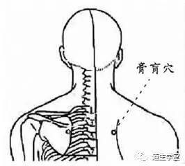 刮痧法的实验原理是什么_中暑刮痧是什么颜色