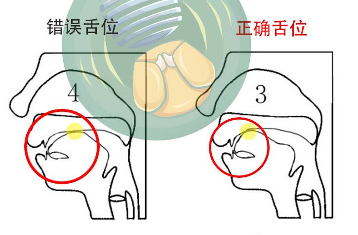 相比之下,2 较 1 发音位置略靠后,但距离正确舌位 3 还有差距——这就