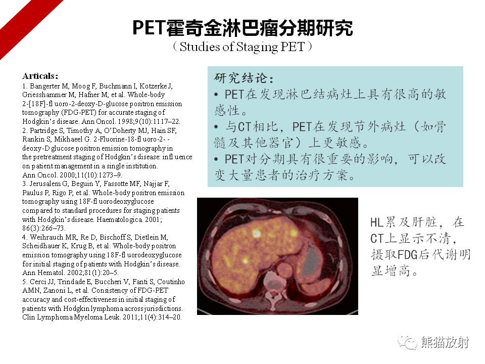 专题petct在霍奇金淋巴瘤中的应用