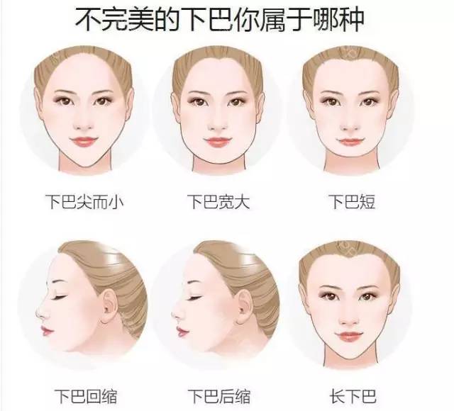 【医美科普】丰下巴选择什么方法好?